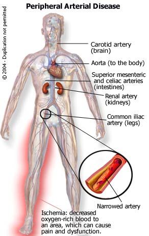 vascular2.jpg